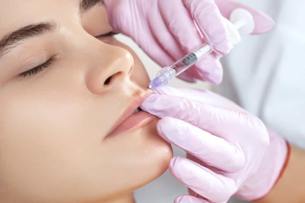 dermal-fillers1