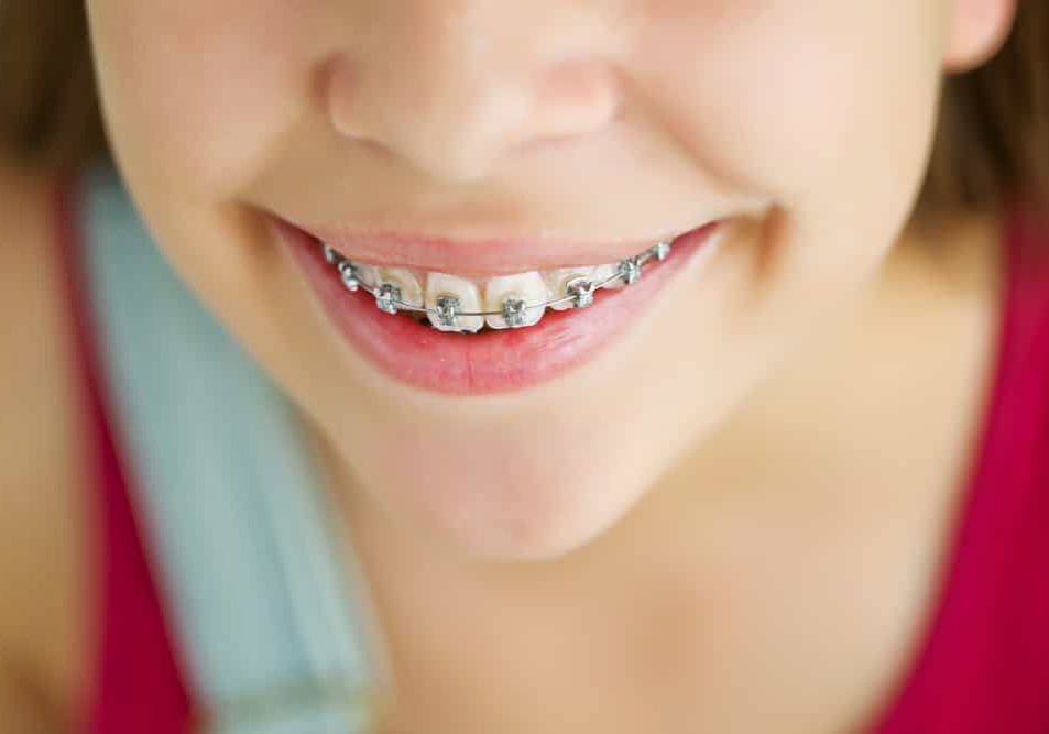 Child orthodontics