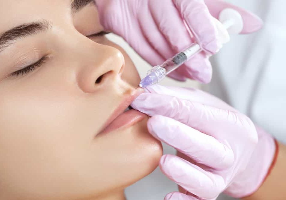 dermal-fillers1